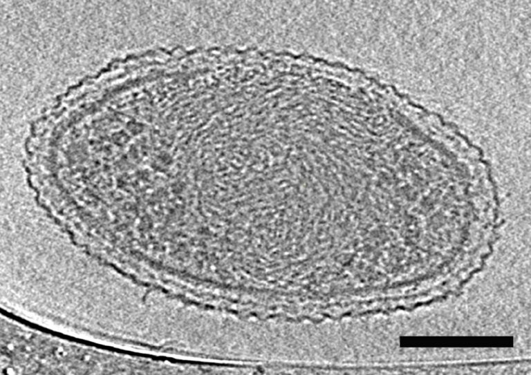 High-magnification electron micrograph of a bacterial or viral structure